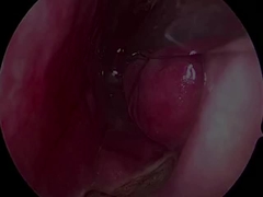 Tek kullanımlık ultra küçük ve esnek nöroloji probu PLA407