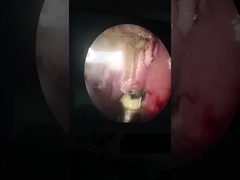 ButterFly Tonsil ve Adenoid için ENT Cerrahi Araçları