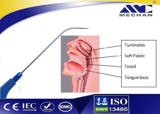 Tubinate Channeling ve Ablasyon için Mekanik Plazma KBB Probu